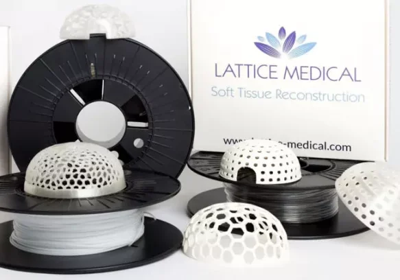 Lattice Medical.jpg